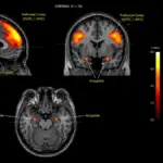 dad jokes brain scan neural activation