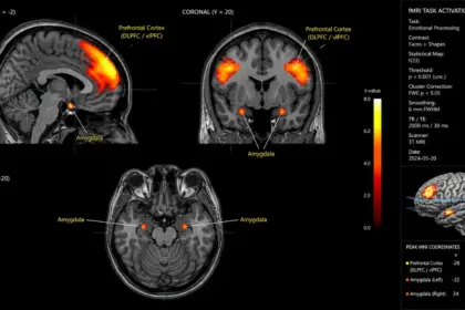 dad jokes brain scan neural activation