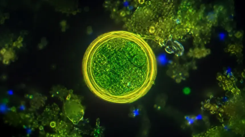 parasitic infection cyclospora oocyst microscopic view